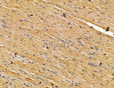 DENND5A Antibody - DF14998 at 1/100 staining rat muscle tissue by IHC-P.