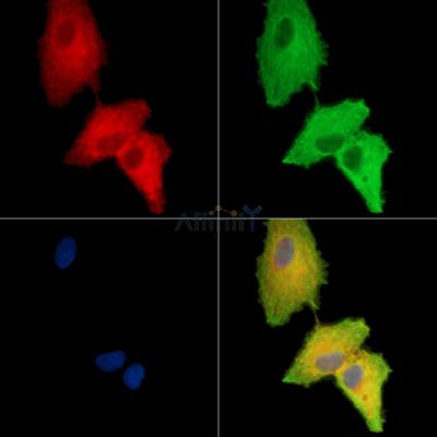 ANKRD27 Antibody - DF15011 staining A549 cells by IF/ICC.