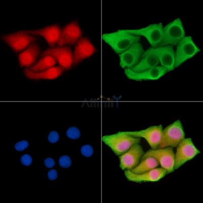 ARL2 Antibody - DF15016 staining Hela cells by IF/ICC.