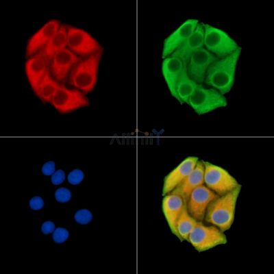 OVOS2 Antibody - DF15019 staining Hela cells by IF/ICC.
