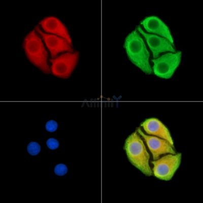 CIT Antibody - DF15023 staining Hela cells by IF/ICC.