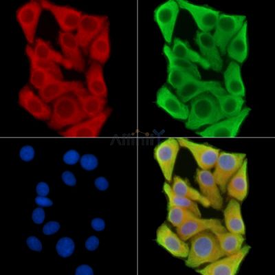 KERA Antibody - DF15032 staining Hela cells by IF/ICC.
