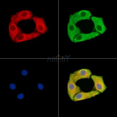 DLGAP4 Antibody - DF15034 staining Hela cells by IF/ICC.