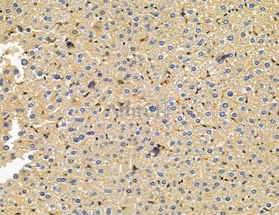 Girdin Antibody - DF15038 at 1/100 staining mouse liver tissue by IHC-P.