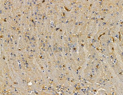 CASP8AP2 Antibody - DF15039 at 1/100 staining rat brain tissue by IHC-P.