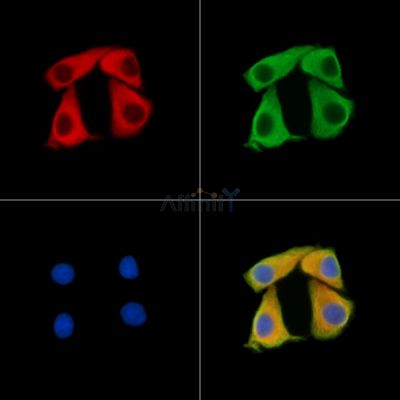 CTAG1A; CTAG1B Antibody - DF15041 staining Hela cells by IF/ICC.