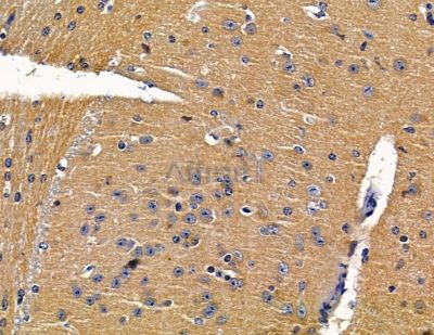 ZNRF2 Antibody - DF15043 at 1/100 staining mouse brain tissue by IHC-P.