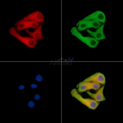 ZNRF2 Antibody - DF15043 staining Hela cells by IF/ICC.