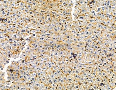 ABRA Antibody - DF15048 at 1/100 staining mouse liver tissue by IHC-P.