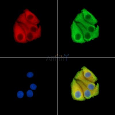 ABRA Antibody - DF15048 staining Hela cells by IF/ICC.