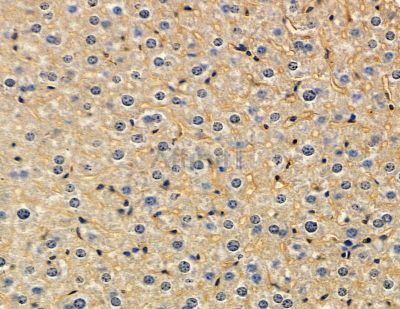 DTX3 Antibody - DF15049 at 1/100 staining mouse liver tissue by IHC-P.