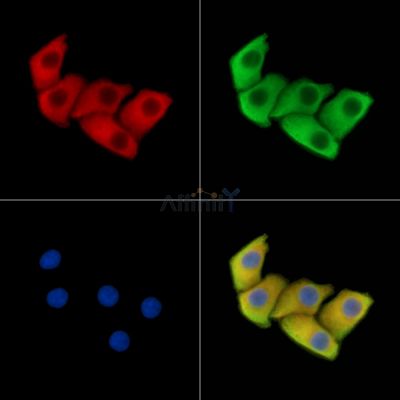 DTX3 Antibody - DF15049 staining Hela cells by IF/ICC.