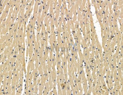 SLC39A3 Antibody - DF15055 at 1/100 staining rat heart tissue by IHC-P.
