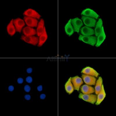 SLC39A3 Antibody - DF15055 staining Hela cells by IF/ICC.