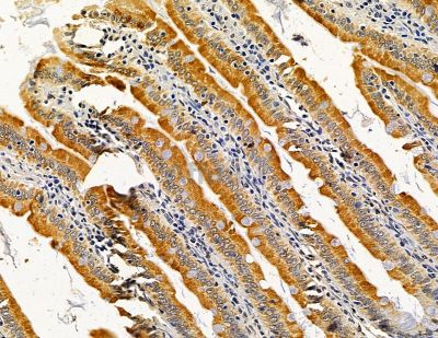 MFSD1 Antibody - DF15057 at 1/100 staining rat colorectal tissue by IHC-P.