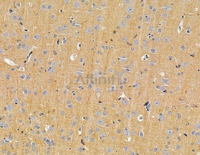 FREM2 Antibody - DF15058 at 1/100 staining rat brain tissue by IHC-P.