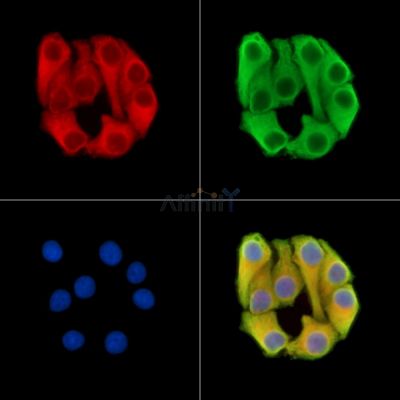 FREM2 Antibody - DF15058 staining Hela cells by IF/ICC.
