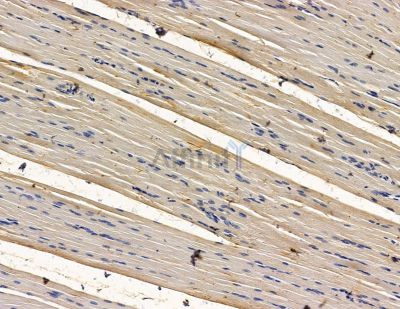 ZFP64 Antibody - DF15064 at 1/100 staining rat muscle tissue by IHC-P.