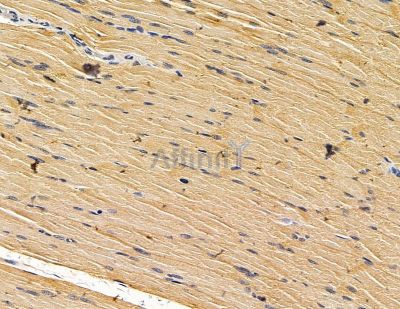 EFHD1 Antibody - DF15067 at 1/100 staining rat muscle tissue by IHC-P.