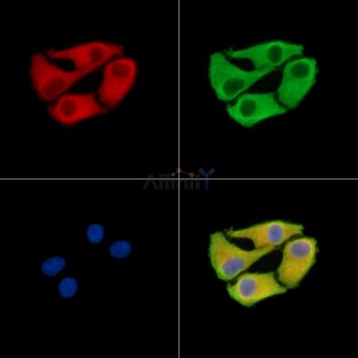 EFHD1 Antibody - DF15067 staining Hela cells by IF/ICC.