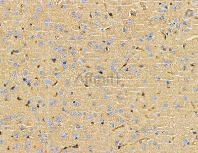 ESYT1 Antibody - DF15071 at 1/100 staining rat brain tissue by IHC-P.
