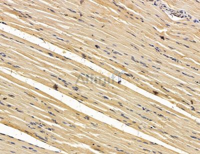ESYT1 Antibody - DF15071 at 1/100 staining rat muscle tissue by IHC-P.