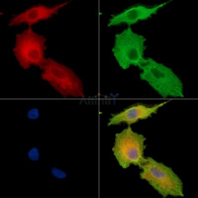 RNASE6 Antibody - DF15080 staining A549 cells by IF/ICC.