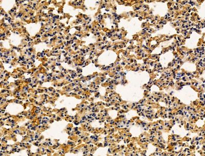 EDDM3B Antibody - DF15081 at 1/100 staining mouse lung tissue by IHC-P.