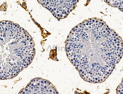 EDDM3B Antibody - DF15081 at 1/100 staining mouse testis tissue by IHC-P.