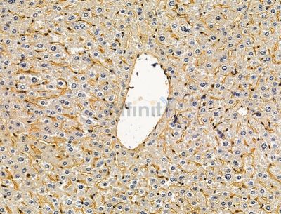 STON2 Antibody - DF15083 at 1/100 staining mouse liver tissue by IHC-P.