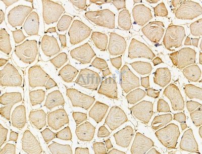 STON2 Antibody - DF15083 at 1/100 staining mouse muscle tissue by IHC-P.