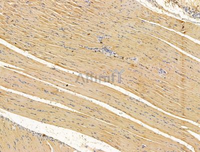 AP1G2 Antibody - DF15085 at 1/100 staining rat muscle tissue by IHC-P.