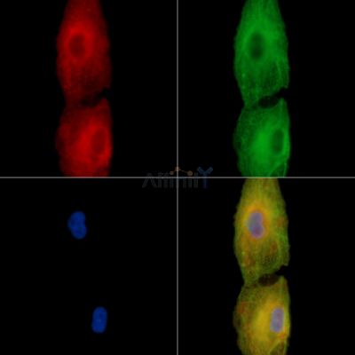 C1orf198 Antibody - DF15087 staining A549 cells by IF/ICC.