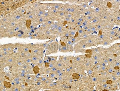 C1orf198 Antibody - DF15087 at 1/100 staining mouse brain tissue by IHC-P.