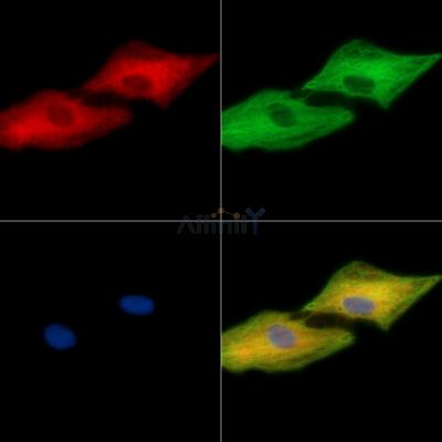 CLMN Antibody - DF15098 staining A549 cells by IF/ICC.