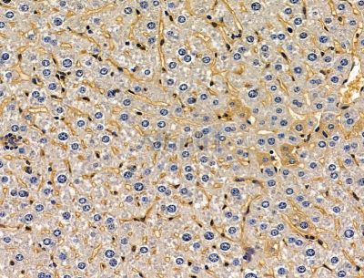 SLFN5 Antibody - DF15106 at 1/100 staining mouse liver tissue by IHC-P.