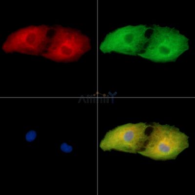 TMEM186 Antibody - DF15107 staining A549 cells by IF/ICC.