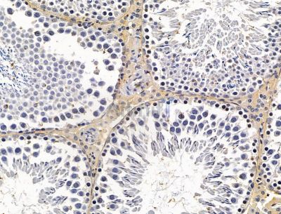 TXNDC2 Antibody - DF15112 at 1/100 staining rat testis tissue by IHC-P.