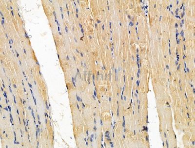 TXNDC17 Antibody - DF15119 at 1/100 staining rat muscle tissue by IHC-P.