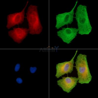 MFSD6L Antibody - DF15122 staining A549 cells by IF/ICC.