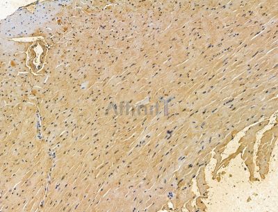 LMCD1 Antibody - DF15126 at 1/100 staining mouse heart tissue by IHC-P.