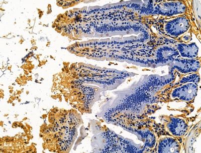ADSS Antibody - DF15130 at 1/100 staining mouse colorectal tissue by IHC-P.
