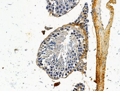 ADSS Antibody - DF15130 at 1/100 staining mouse testis tissue by IHC-P.