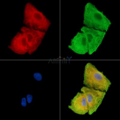 FAM83H Antibody - DF15132 staining A549 cells by IF/ICC.
