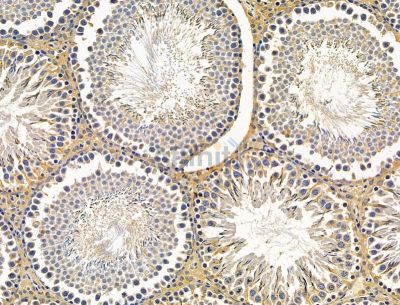 FAM83H Antibody - DF15132 at 1/100 staining rat testis tissue by IHC-P.