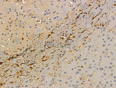 TRMT1L Antibody - DF15135 at 1/100 staining mouse brain tissue by IHC-P.
