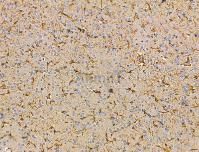 TRMT1L Antibody - DF15135 at 1/100 staining rat brain tissue by IHC-P.