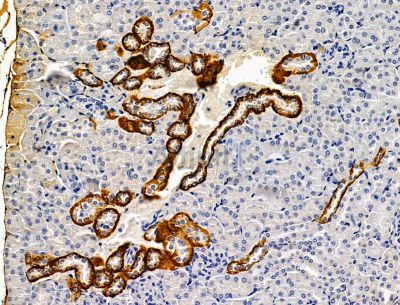 CXorf23 Antibody - DF15138 at 1/100 staining mouse kidney tissue by IHC-P.