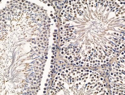 INAVA Antibody - DF15139 at 1/100 staining rat testis tissue by IHC-P.