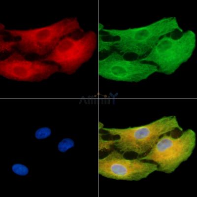 DNAH8 Antibody - DF15141 staining A549 cells by IF/ICC.